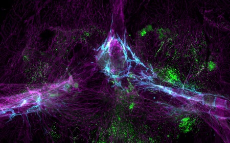 The brain's immune system includes a network of transport vessels (blue) and its own immune cells made in the bone marrow (green).