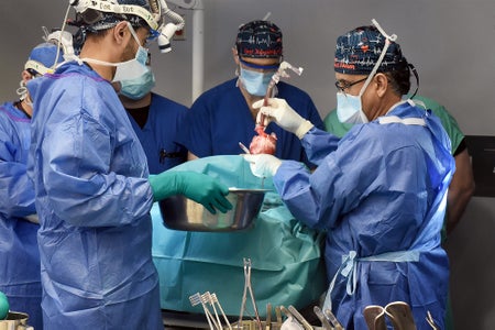 A team of surgeons in an operating room lifting a heart above their patient on the operating table